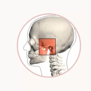 O que é Disfunção Temporomandibular (DTM)?